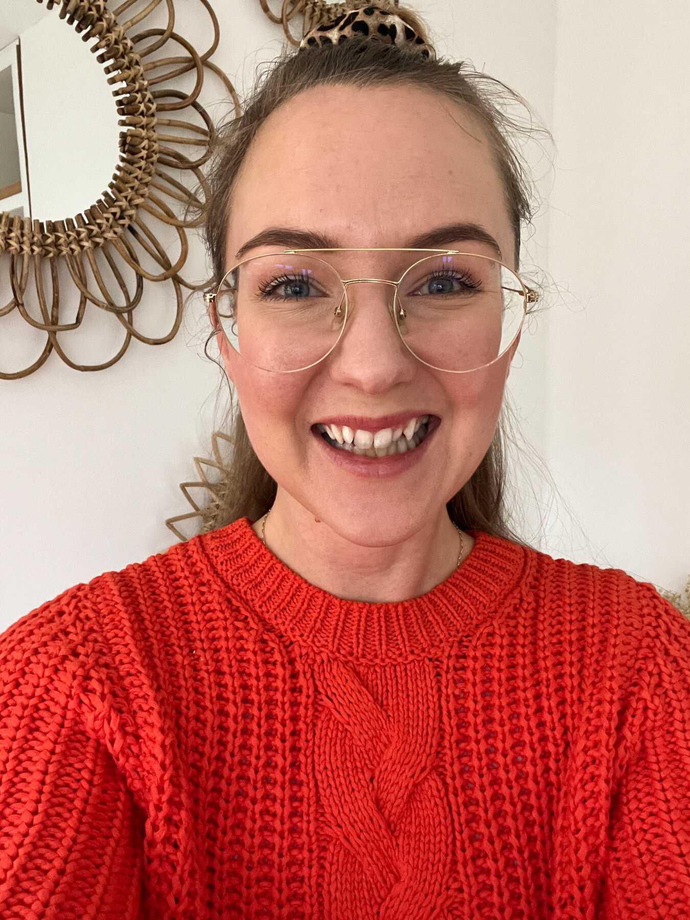 Invisalign post @wilvantien-2